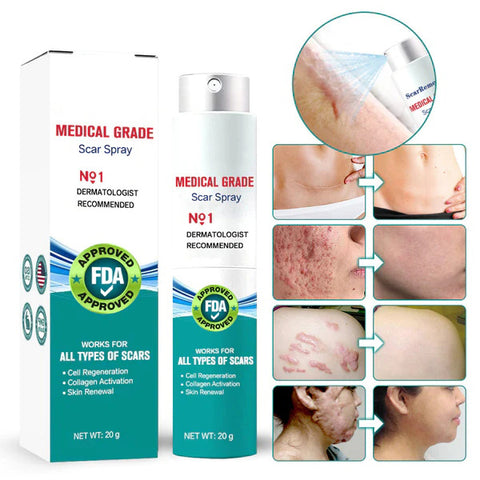 ScarRemove™ Advanced Scar Spray